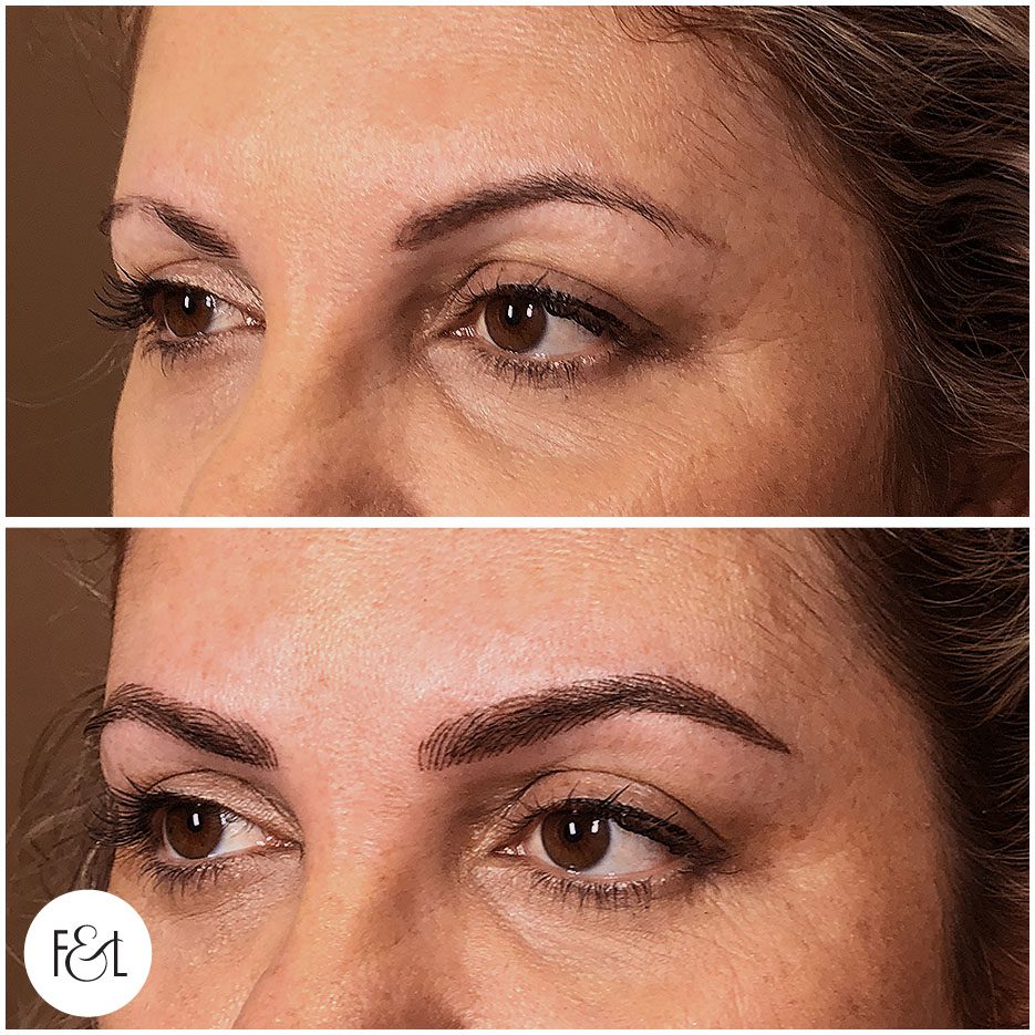 Belinda before and after brows