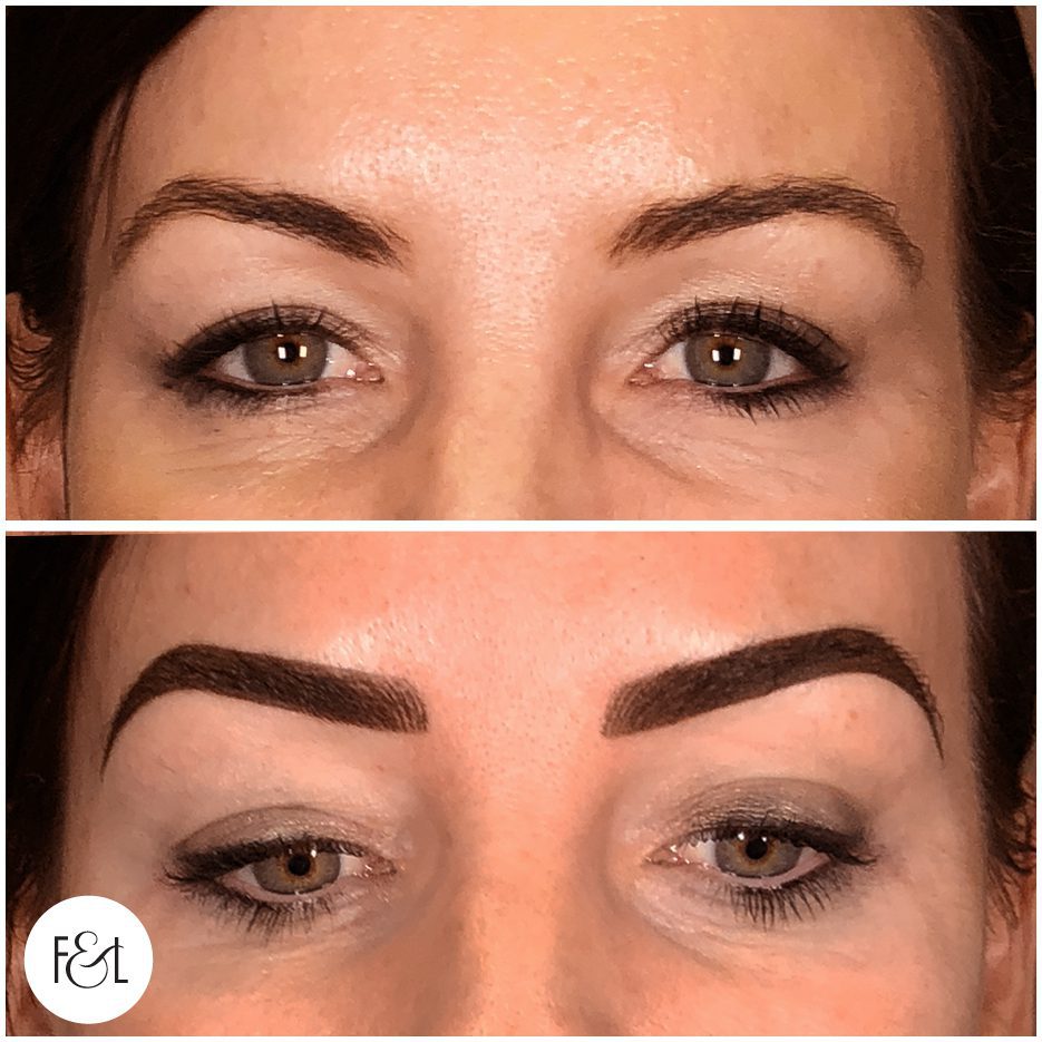 combo brows before and after gold coast