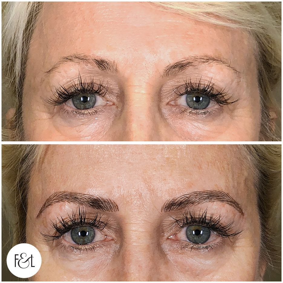 microblading before and after photos gold coast