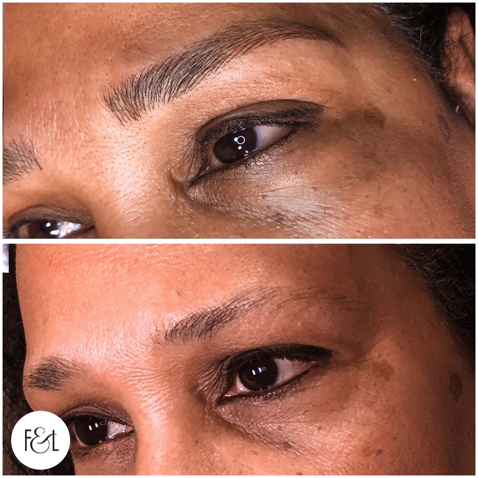 before and after brows