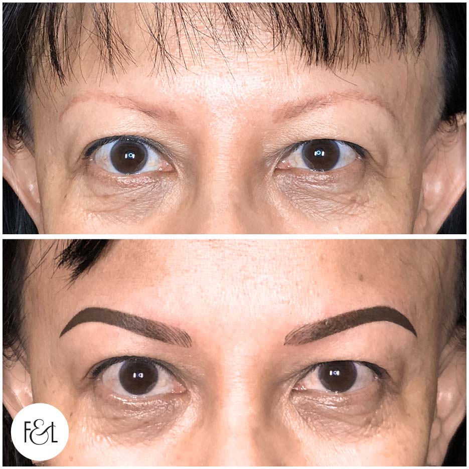 healed combo brows before and after