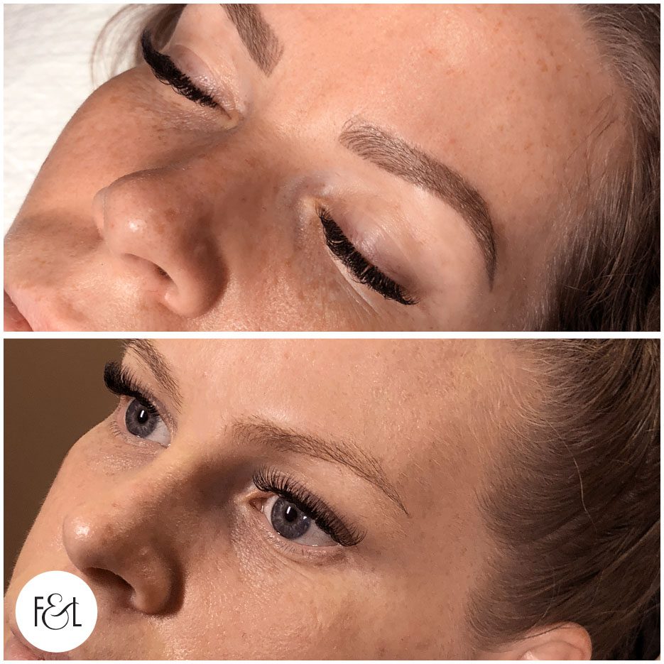 before and after combo brows tattoo
