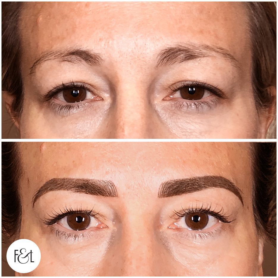 emma before and after healed brows