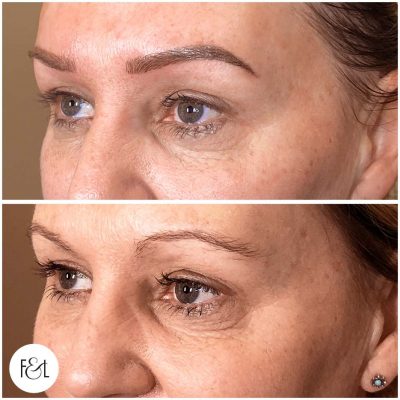 cindy before and after eyebrow tattoo