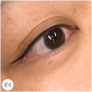 Petite Wing Eyeliner Tattoo- Immediately after treatment